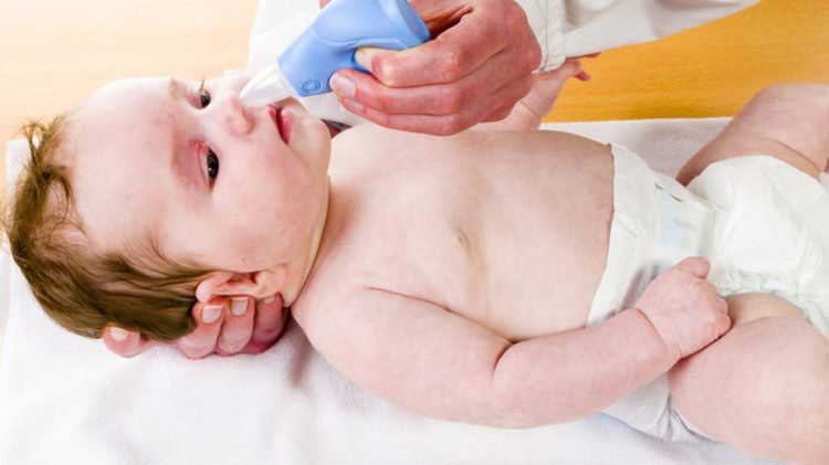 Chữa nghẹt mũi ở trẻ sơ sinh bằng cách hút mũi