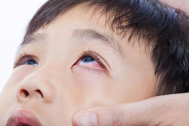 các bệnh thường gặp ở trẻ nhỏ
