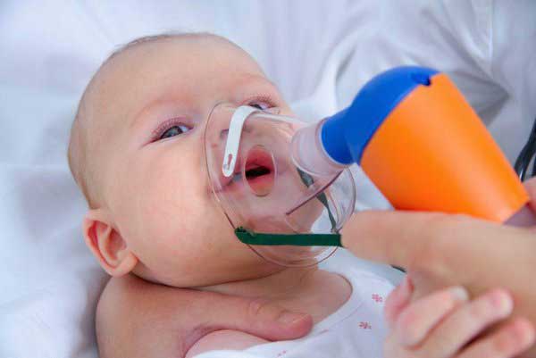 Trẻ sơ sinh thở khò khè có sao không cũng tùy vào từng nguyên nhân